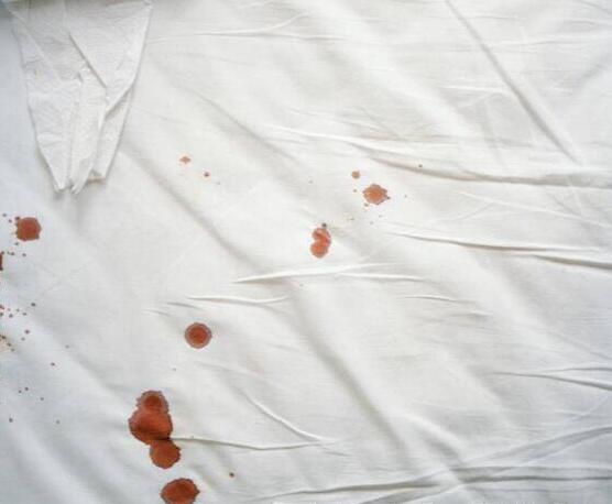 白大褂剛沾染血漬時(shí)